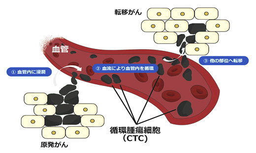 血液内を循環するがん細胞「CTC」